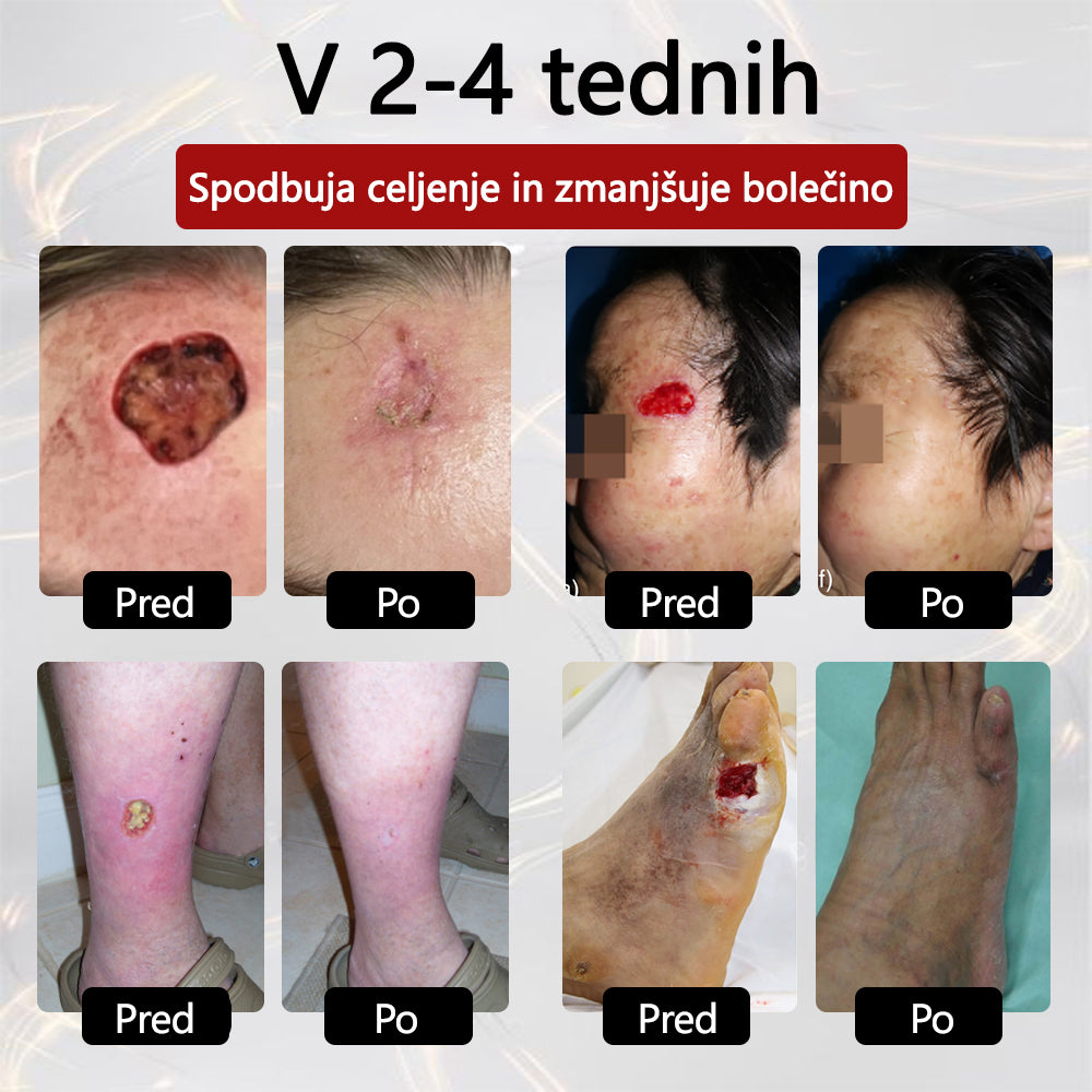✨👣 TOPWAL® GlucoseGuard Skin Rescue Krema – Hitrejše celjenje, varnejša zaščita in vsakodnevna hidracija za diabetično kožo 🌿💧