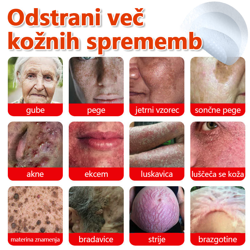 👨⚕️ GFOUK® MicroNeedle obliž za odstranjevanje kožnih izrastkov 🇪🇺 Skupno z EU smernicami za nego kože