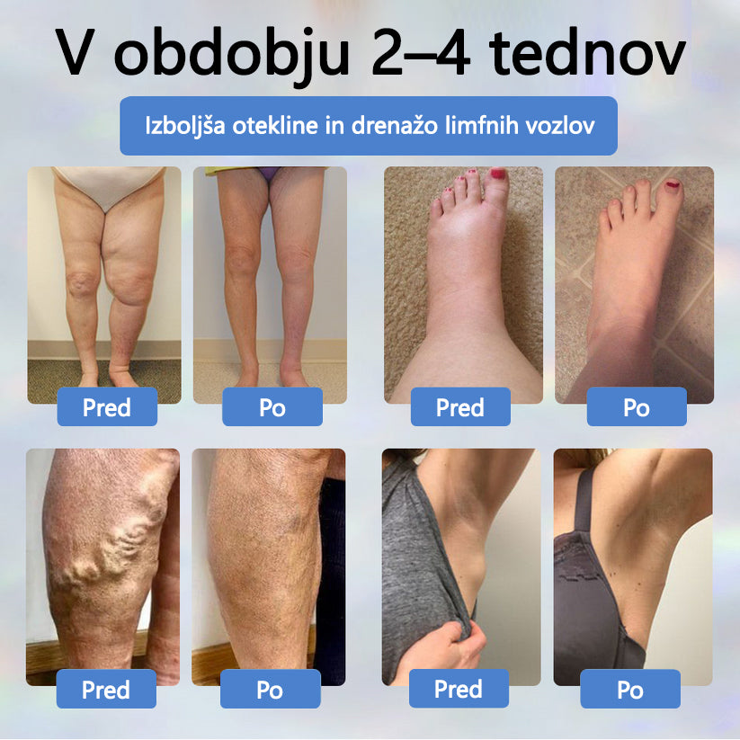 ATTDX® Črni kumen – zeliščna krema za pomiritev oteklin 🌿🦵