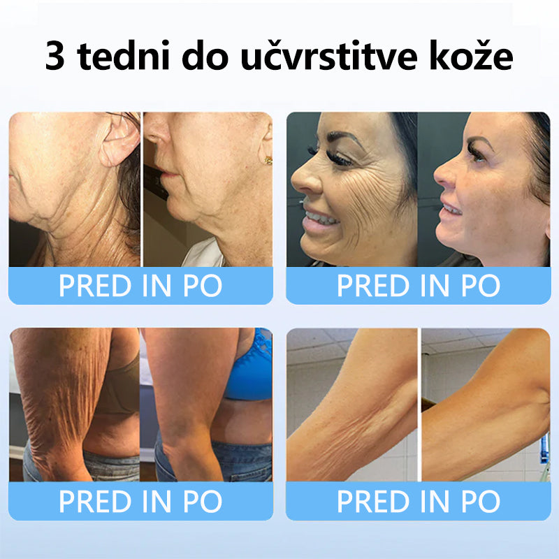 TLOPA™ Kolagenski Peptidi FIRMING SERUM PALČEK