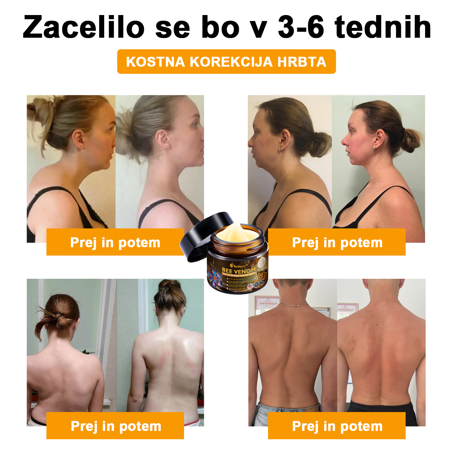 🔥 𝘈𝘦𝘵𝘩𝘦𝘳𝘪𝘴™ Krema za lajšanje artritisa s čebeljim strupom (posebej za starejše odrasle) 🦴– zadnji dan promocije: 70 % popusta 💪