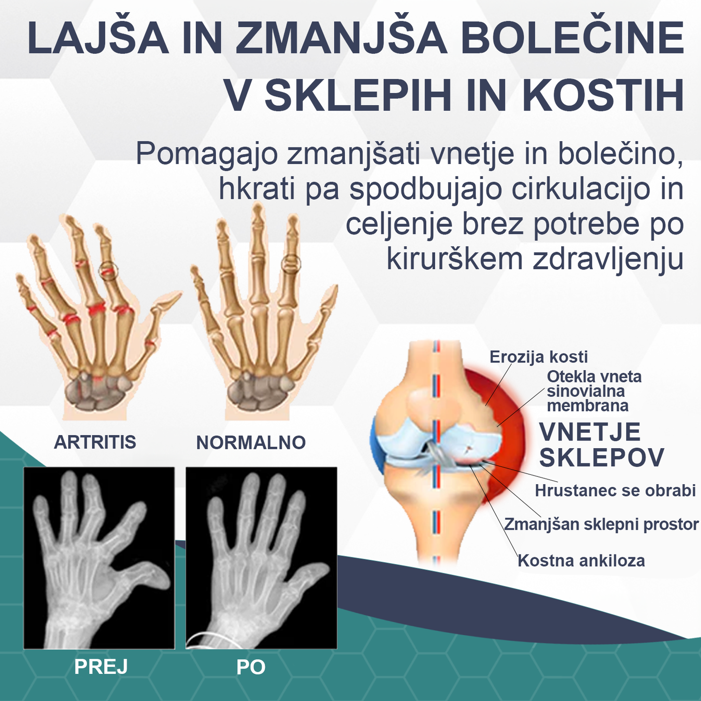 🌈🌈𝐓𝐎𝐃𝐀𝐇𝐎𝐅™ Krema za lajšanje bolečin in celjenje kosti s čebeljim strupom🔥Primerno za vse starosti💎 Časovno omejeno 60 % popusta💎