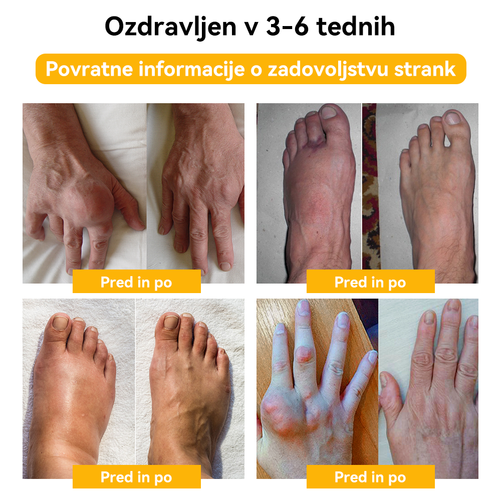 ✅ Uradna trgovina: 𝐒𝐩𝐳𝐯®📦 Č𝐞𝐛𝐞𝐥𝐣𝐢 𝐒𝐭𝐫𝐮𝐩 𝐒𝐤𝐥𝐞𝐩𝐢 & 𝐊𝐨𝐬𝐭𝐢 𝐙𝐝𝐫𝐚𝐯𝐥𝐣𝐞𝐧𝐣𝐞 𝐊𝐫𝐞𝐦𝐚 🐝 (𝐙𝐧𝐚č𝐚𝐣𝐧𝐨 za 𝐨𝐫𝐭𝐨𝐩𝐞𝐝𝐬𝐤𝐞 𝐛𝐨𝐥𝐞𝐳𝐧𝐢 𝐢 𝐛𝐨𝐥𝐞č𝐢𝐧𝐞 𝐩𝐫𝐢 𝐚𝐫𝐭𝐫𝐢𝐭𝐢𝐬𝐮)