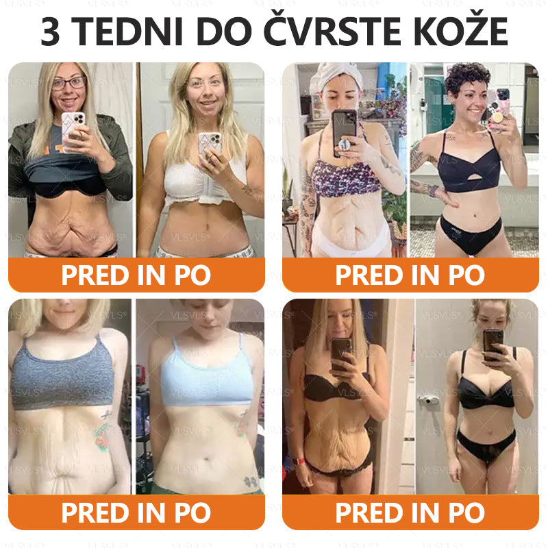 💟 Dermatologi priporočajo ✨ ZödVita® obnavljajoča krema z čebeljim strupom 🔥  CE-certifikat in ga priporoča Slovensko dermatološko društvo (SDD)