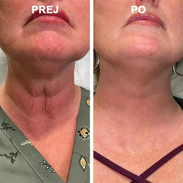 🌿𝐅𝐮𝐛𝐬𝐭𝐚® pomlajevalno olje za učvrstitev kože🩵 Zadnji dan popusta: 75 % CENEJE💧