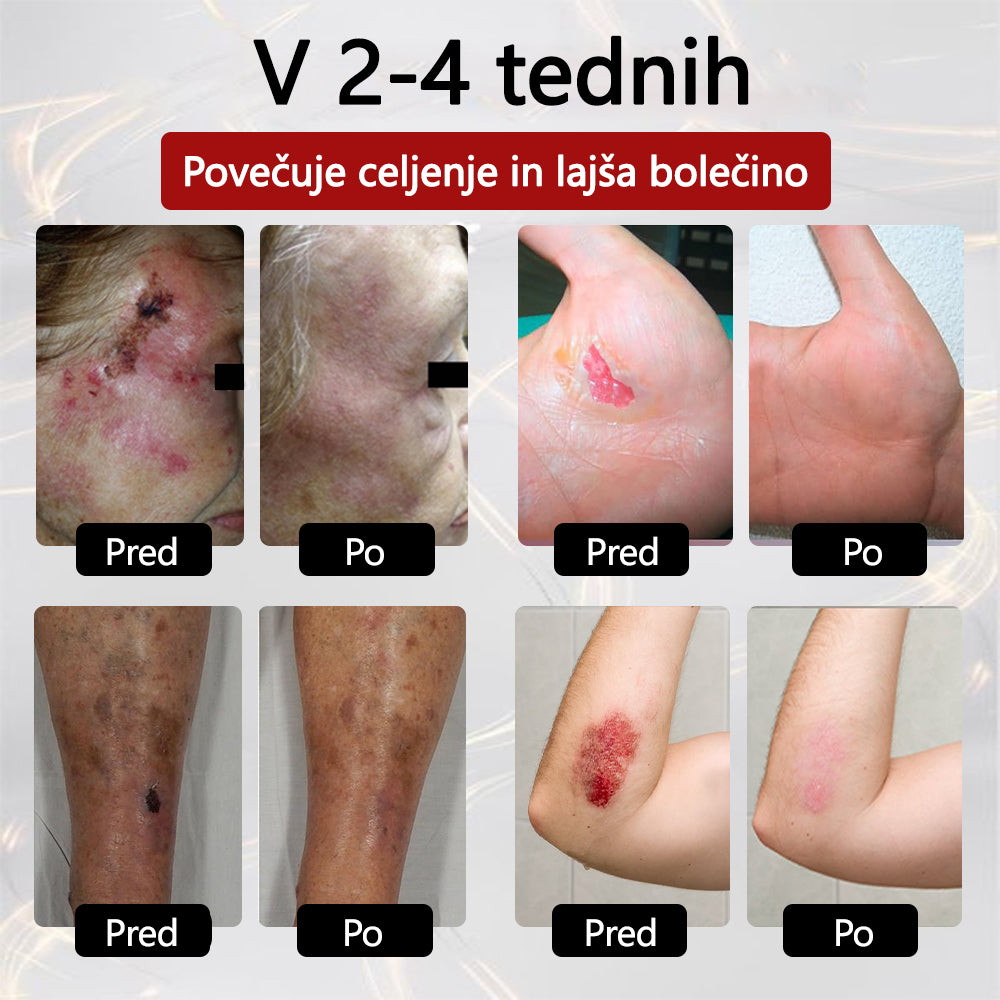 ✨👣 TOPWAL® GlucoseGuard Skin Rescue Krema – Hitrejše celjenje, varnejša zaščita in vsakodnevna hidracija za diabetično kožo 🌿💧