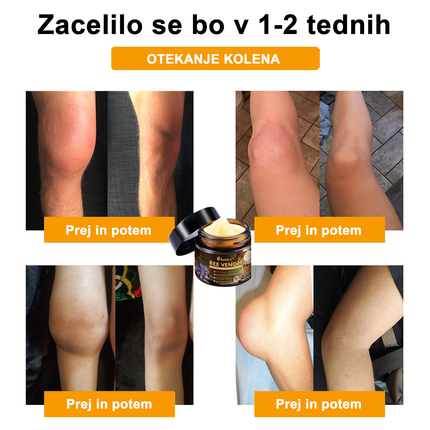 🔥 𝘈𝘦𝘵𝘩𝘦𝘳𝘪𝘴™ Krema za lajšanje artritisa s čebeljim strupom (posebej za starejše odrasle) 🦴– zadnji dan promocije: 70 % popusta 💪