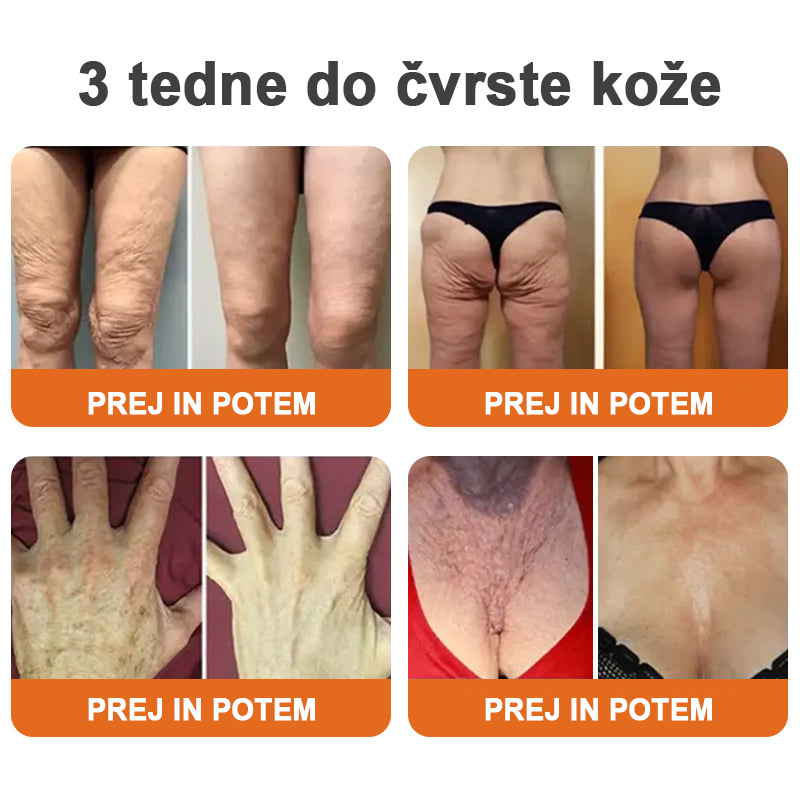 ✨Flysmus™ Botox Čebelji Strup Firming Stick🔥ZADNJI DAN 70 % CENEJE