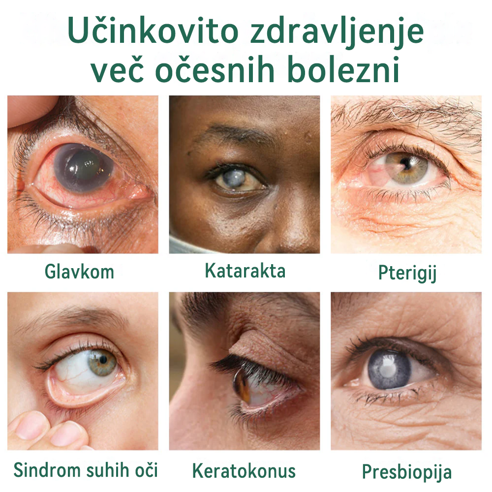 👩⚕️Ourlyard® Nano kapljice za oči ✅Odobreno s strani EMA (primerno za daljnovidnost, sindrom suhega očesa, glavkom in sivo mreno) ☘️