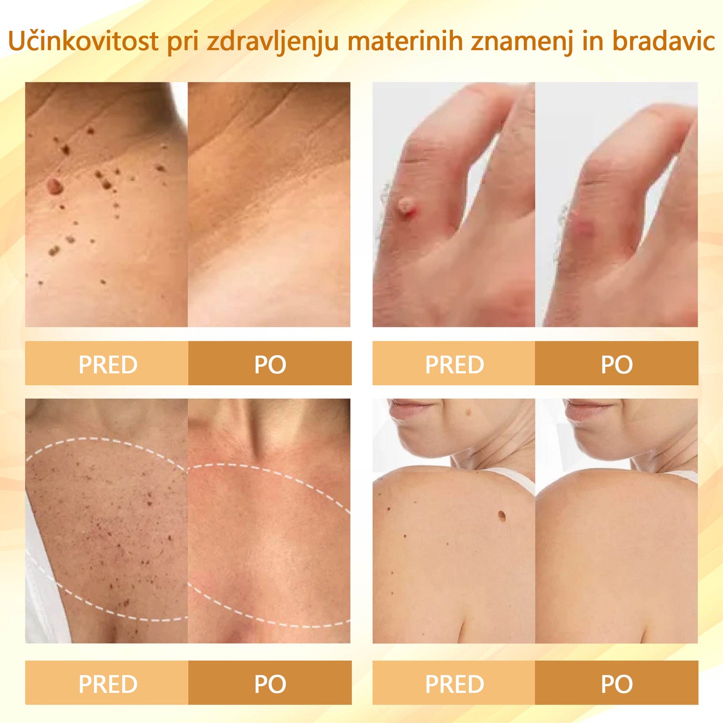 🌟 TOPWAL® Condense Krema za obnovo kože z čebeljim strupom 🌿 Spodbuja regeneracijo kože 💧 Globoko vlaži in neguje ✨ Zmanjšuje drobne gube in linije 🐝 Obogatena z naravnim čebeljim strupom ✔️ Primerna za vse tipe kože, tudi občutljivo