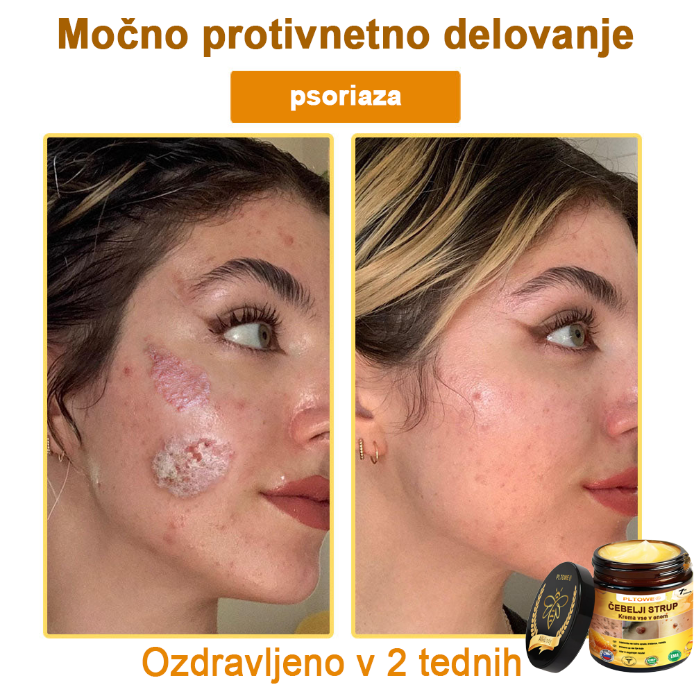 ZADNJA PRILOŽNOST! Zgrabi to srečno najdbo s 70 % Popustom! 🔥180-DNEVNO GARANCIJA VRAČILA DENARJA!