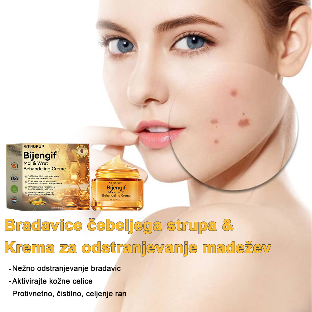 ✨🎁𝑭𝑹𝑶𝑷𝑼𝑵™ krema za odstranjevanje znamenj in madežev (85% popust zadnji dan dogodka)