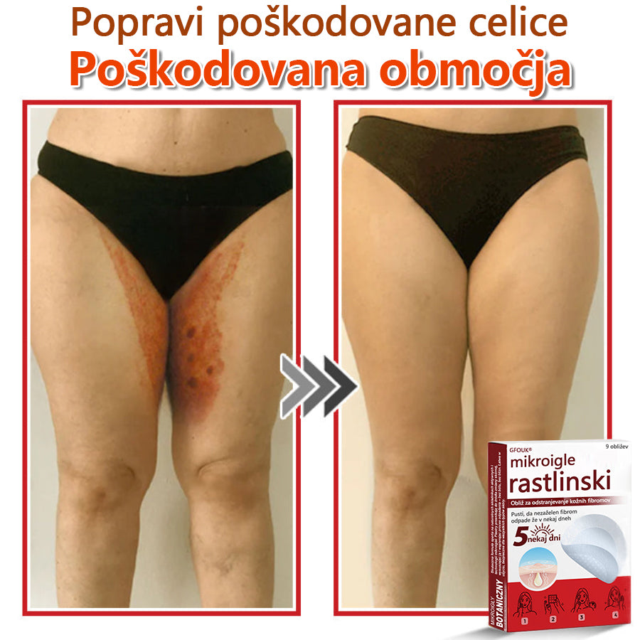 👨⚕️ GFOUK® MicroNeedle obliž za odstranjevanje kožnih izrastkov 🇪🇺 Skupno z EU smernicami za nego kože