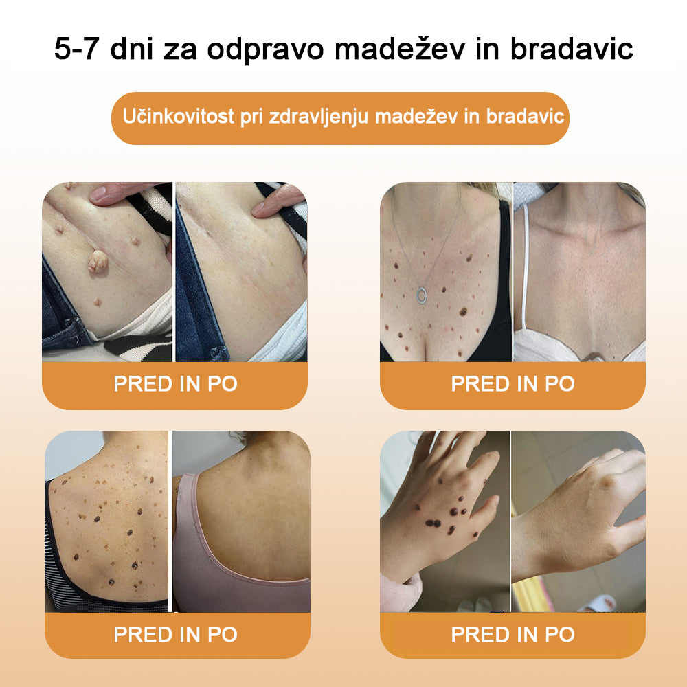 🍊𝑻𝒖𝒓𝒐𝒏𝒖™ Zdravilno mazilo s čebeljim strupom (👨⚕𝐀𝐀𝐃 PRIPOROČILA)