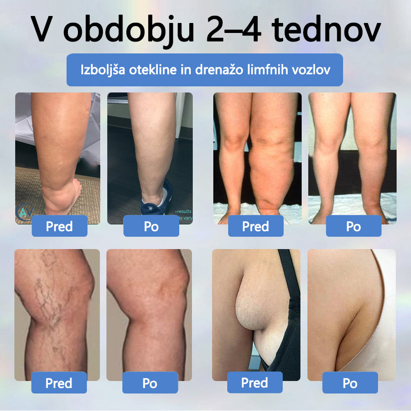 ATTDX® Črni kumen – zeliščna krema za pomiritev oteklin 🌿🦵