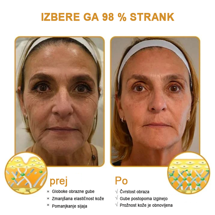 🍀 Zadnji dan promocije: 83 % popust ✨𝐅𝐮𝐫𝐳𝐞𝐫𝐨™ Kremni odstranjevalec gub z čebeljim strupom in botoks učinkom🐝