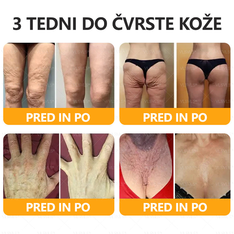 ✨ VLSVLS® krema za obnovo kože s čebeljim strupom 🔥 ZADNJI DAN 80% CENEJE