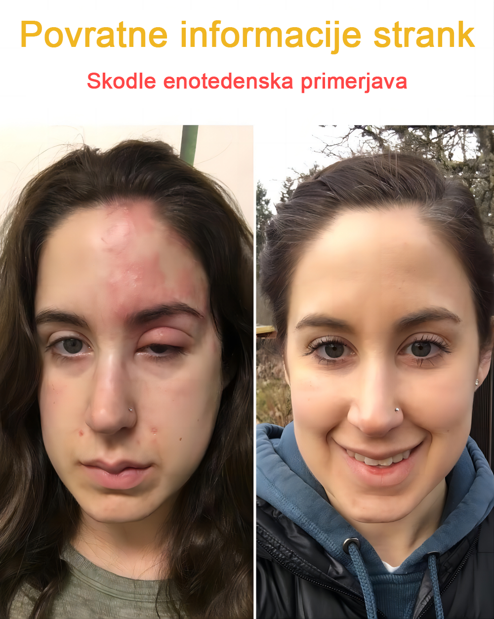 🐝✨𝑩𝑺𝑾𝑬𝑳𝑳® Krema za nego kože z čebeljim strupom👨⚕️ (Priporočena s strani AAD) (🔥 Zadnji dan promocije, prihranite 70%)