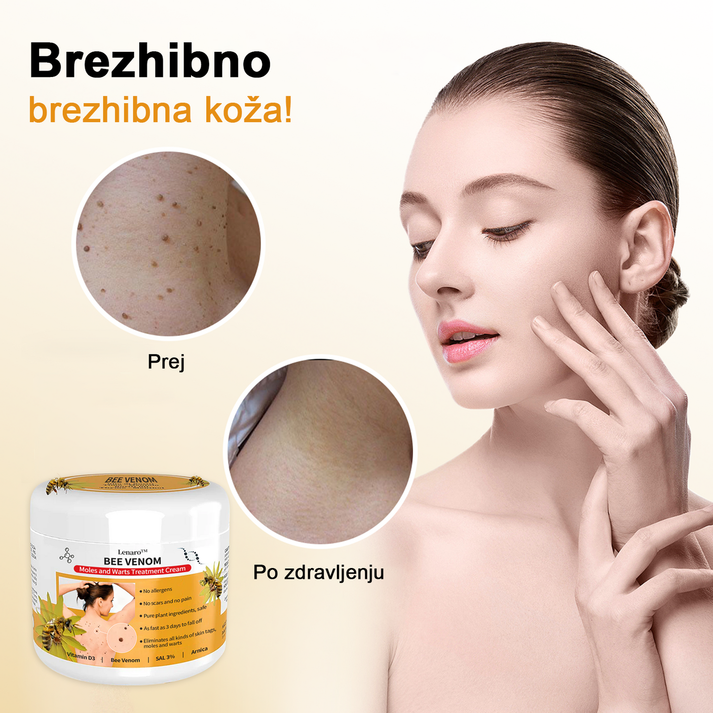 🐝 Krema Lenaro™ za zdravljenje madežev in bradavic 💎💎💎Primerna za vse starostne kategorije🐝