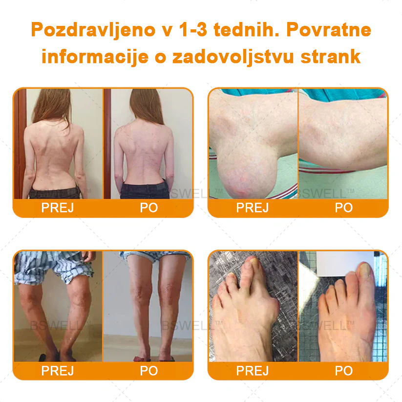 BSWELL™ Lidokain Gel za lajšanje bolečin- (zmanjšuje otekanje sklepov, bolečino, okorelost, rdečico, toploto, bolečino in utrujenost sklepov), 4% lidokain, glukozamin, MSM, arnika, hondroitin, vitamin K2.