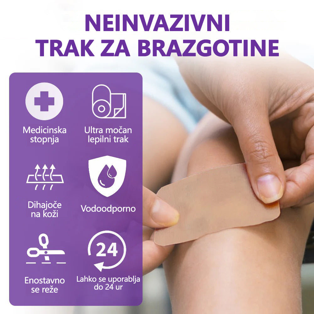 🏷️ Uradna Trgovina: flysmus® ReGen Mikronadlaste Ploščice z Nano-Hialuronsko Kislino (Nano-Heal) 💝 Zdravljenje novih in starih brazgotin, zmanjševanje kirurških brazgotin, strij, keloidov, aken, opeklin, bradavic, dermatomov in krčnih žil