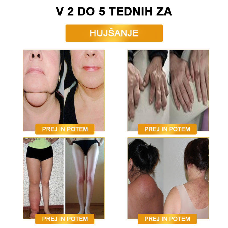 🔥𝙅𝙊𝙎𝙁𝙄𝙏™ Ultrazvočna zapestnica za razstrupljanje maščob in uravnavanje krvnega sladkorja z daljnim infrardečim sevanjem  🌸