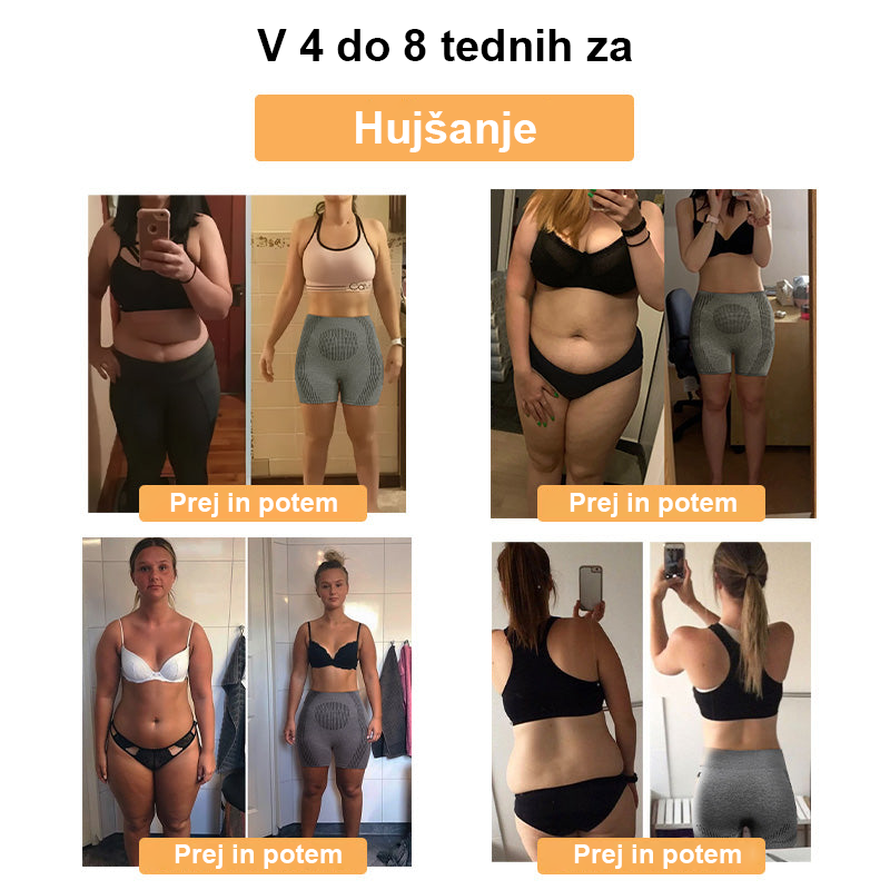 ✨【Pripravljeno na jesen 2025】𝐒𝐡𝐨𝐫𝐭𝐬™ mikrovibracijski masažni modul, popravilo ionskih vlaken, kratke hlače za oblikovanje🌻