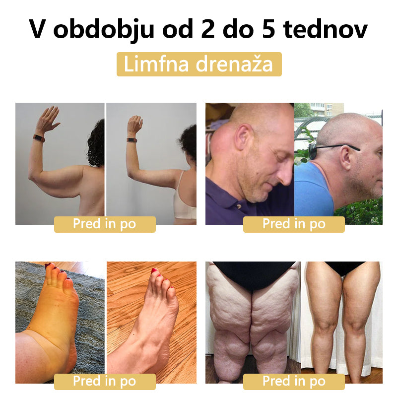 (🔥POSEBNA ZADNJI DAN RAZPRODAJE - 80 % POPUST) 🍁💖 CZTICLE™ Limfna terapija z magnetoterapijo Germanij-uhani