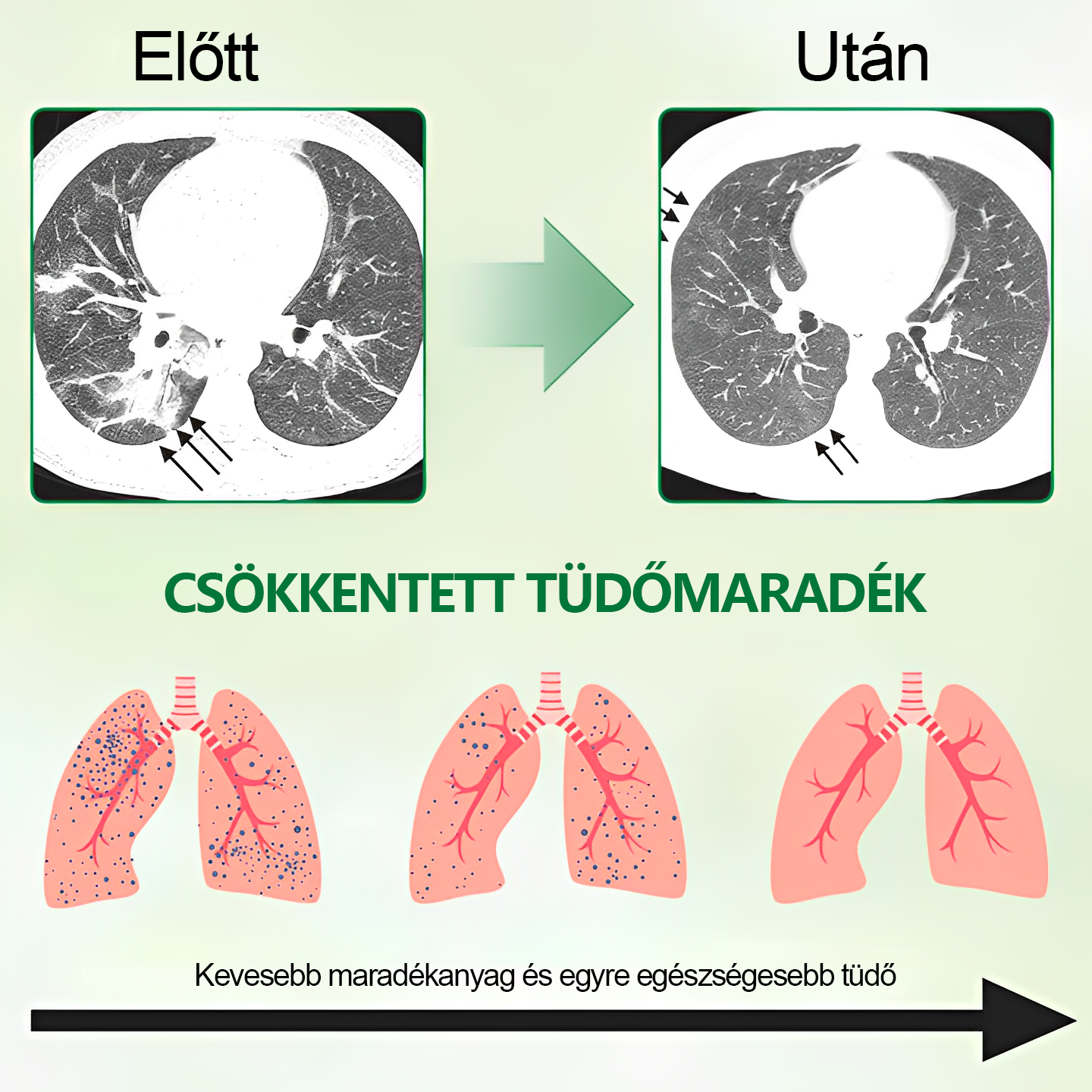 🍀 𝐆𝐨𝐨𝐲𝐞𝐞𝐫™ napreden sprej za čiščenje pljuč – podpira zdravje pljuč, bronhijev in nosnih votlin, spodbuja zdravje dihalnega sistema in lažje dihanje.