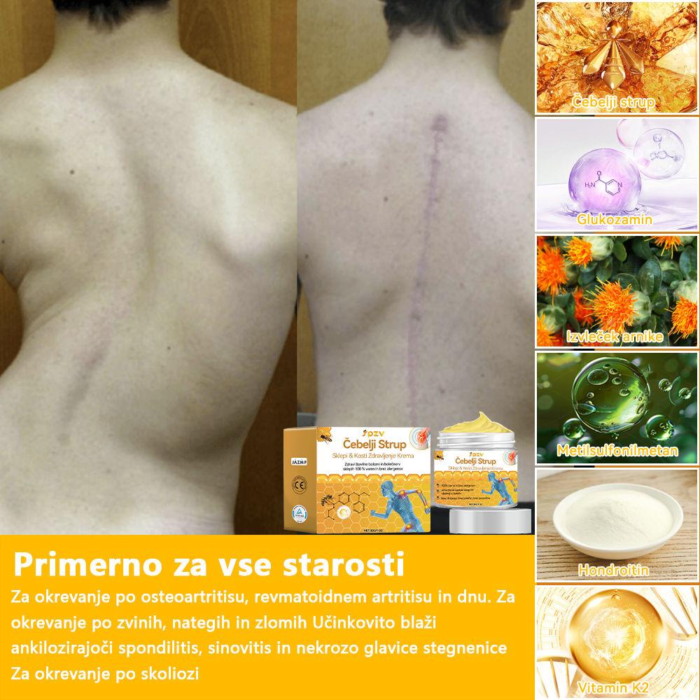 ✅ Uradna trgovina: 𝐒𝐩𝐳𝐯®📦 Č𝐞𝐛𝐞𝐥𝐣𝐢 𝐒𝐭𝐫𝐮𝐩 𝐒𝐤𝐥𝐞𝐩𝐢 & 𝐊𝐨𝐬𝐭𝐢 𝐙𝐝𝐫𝐚𝐯𝐥𝐣𝐞𝐧𝐣𝐞 𝐊𝐫𝐞𝐦𝐚 🐝 (𝐙𝐧𝐚č𝐚𝐣𝐧𝐨 za 𝐨𝐫𝐭𝐨𝐩𝐞𝐝𝐬𝐤𝐞 𝐛𝐨𝐥𝐞𝐳𝐧𝐢 𝐢 𝐛𝐨𝐥𝐞č𝐢𝐧𝐞 𝐩𝐫𝐢 𝐚𝐫𝐭𝐫𝐢𝐭𝐢𝐬𝐮)