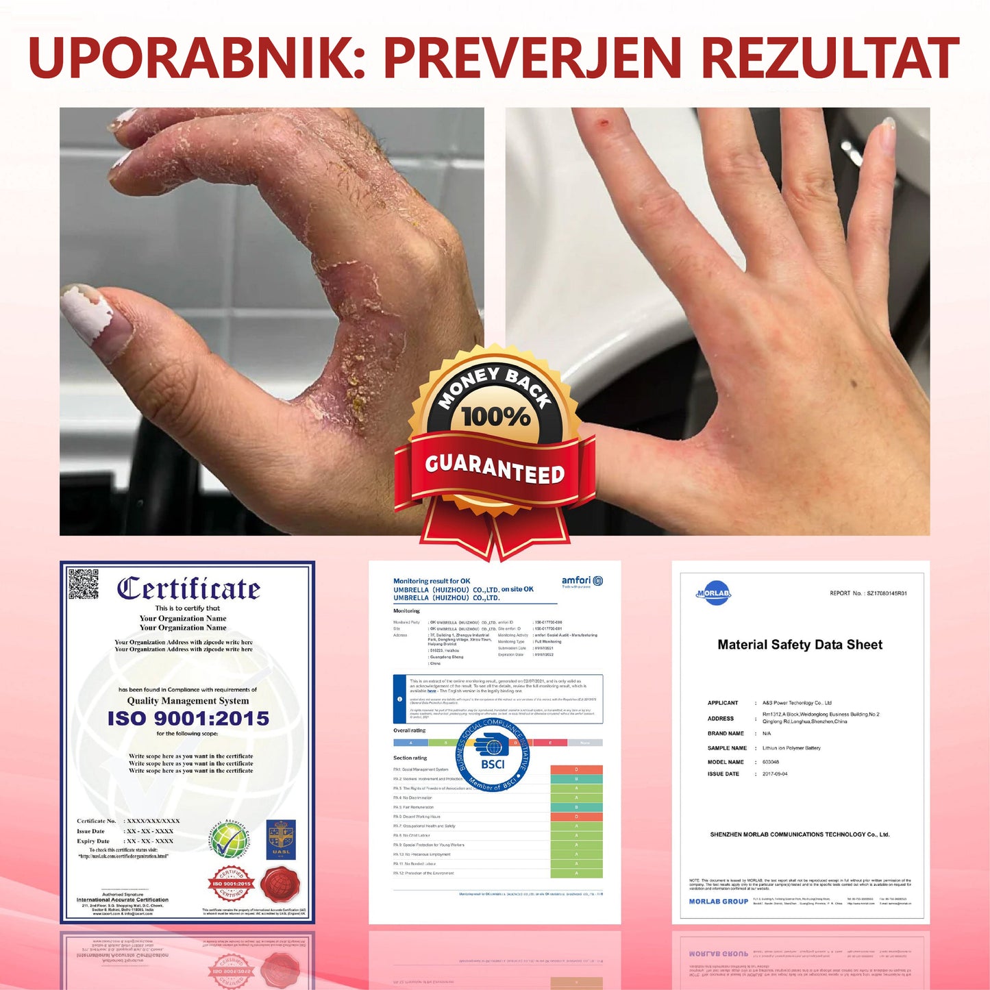 ✨👣 TOPWAL® GlucoseGuard Skin Rescue Krema – Hitrejše celjenje, varnejša zaščita in vsakodnevna hidracija za diabetično kožo 🌿💧