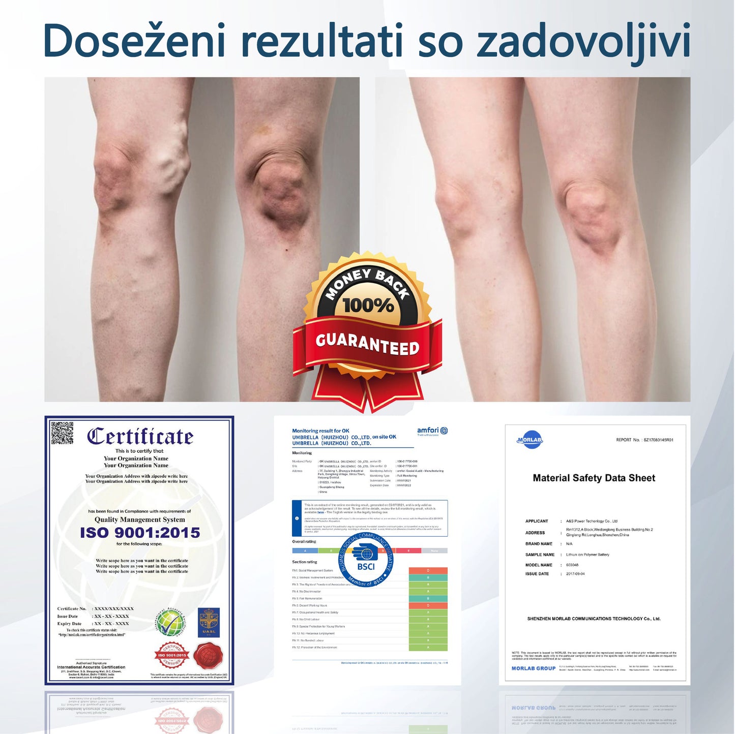 ATTDX® Črni kumen – zeliščna krema za pomiritev oteklin 🌿🦵
