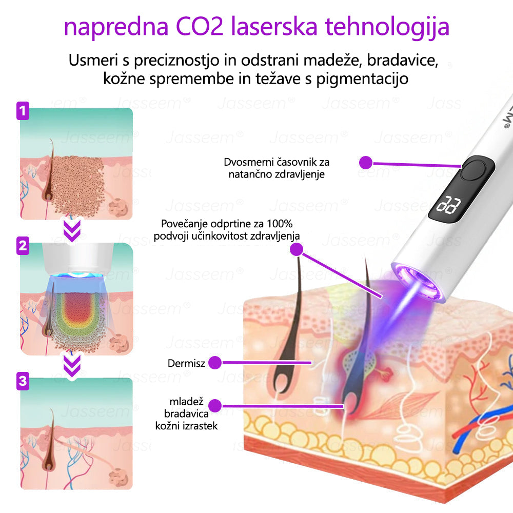𝐉𝐚𝐬𝐬𝐞𝐞𝐦® Napredni neinvazivni CO₂ laserski pisalo za obnovo kože 🛫 (Nežno odstrani bradavice, materina znamenja, starostne pege in kožne izrastke – brez bolečin in brez kompliciranja!)
