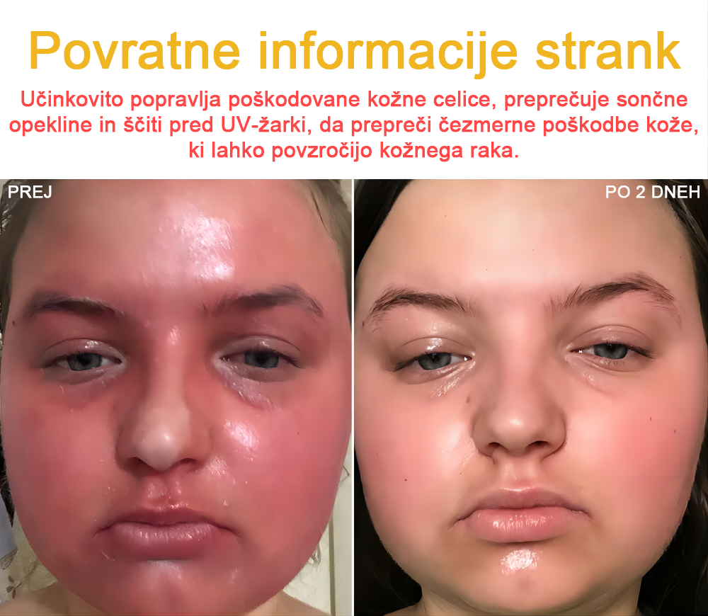 🐝✨𝑩𝑺𝑾𝑬𝑳𝑳® Krema za nego kože z čebeljim strupom👨⚕️ (Priporočena s strani AAD) (🔥 Zadnji dan promocije, prihranite 70%)