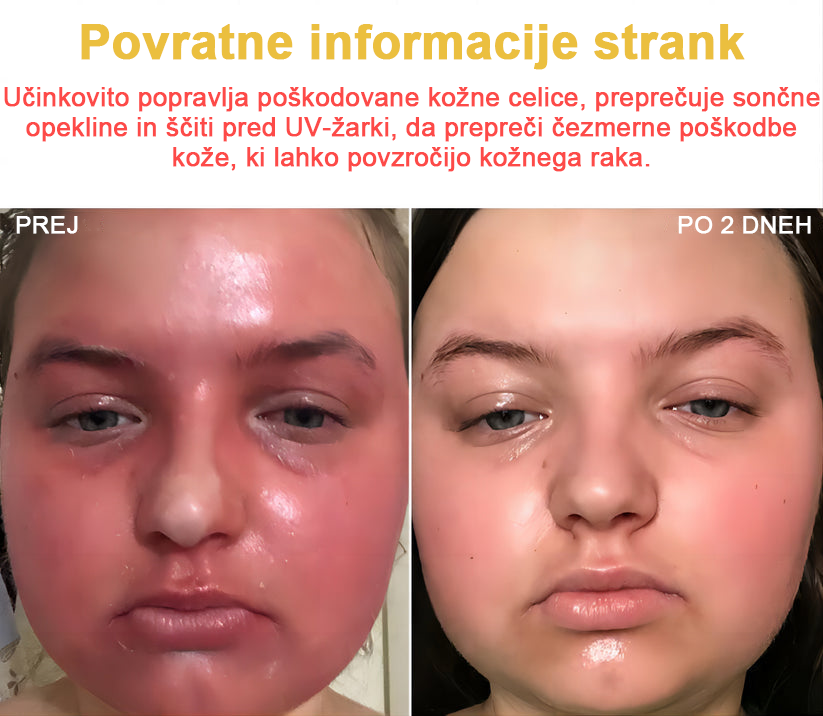 𝑽𝒆𝒍𝒊𝒔𝒔𝒆™ 2024 (priporoča AAD), za odstranjevanje bradavic, aken in brazgotin. Zdravi različne kožne bolezni