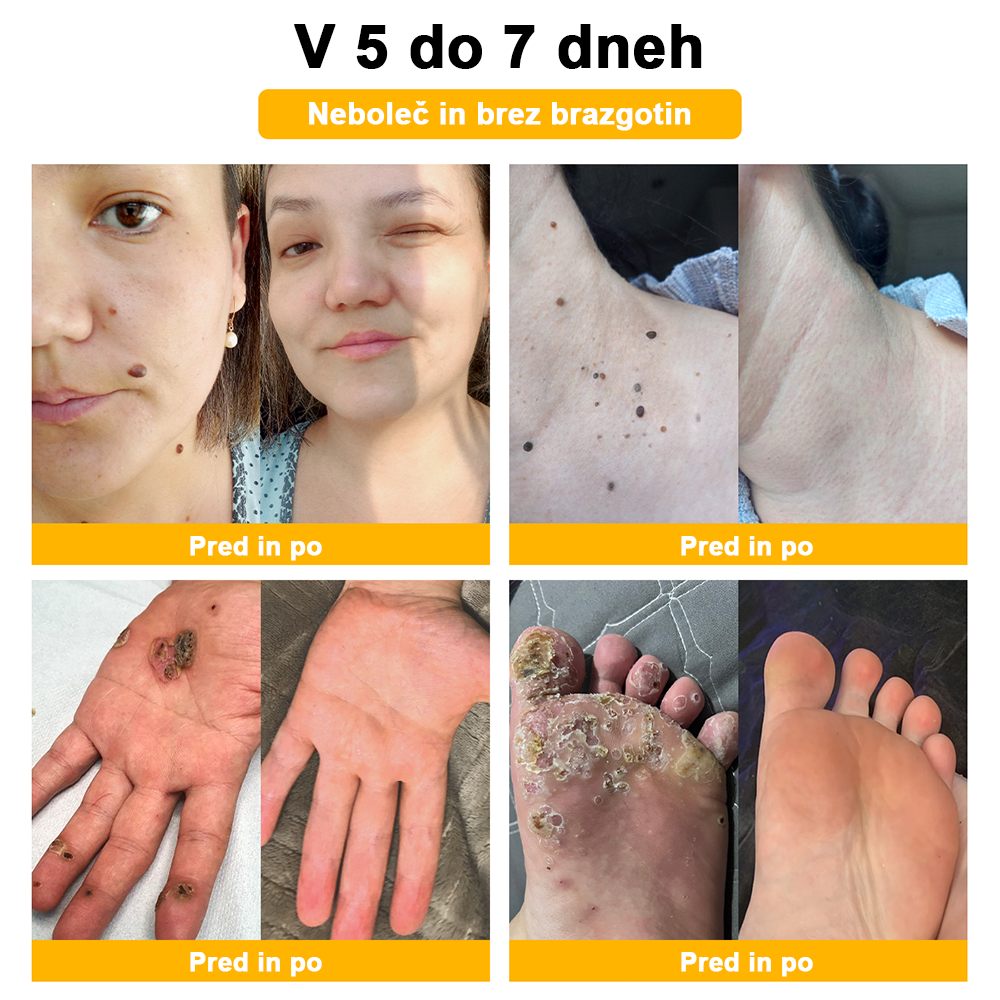 🍊𝑻𝒖𝒓𝒐𝒏𝒖™ Zdravilno mazilo s čebeljim strupom (👨⚕𝐀𝐀𝐃 PRIPOROČILA)