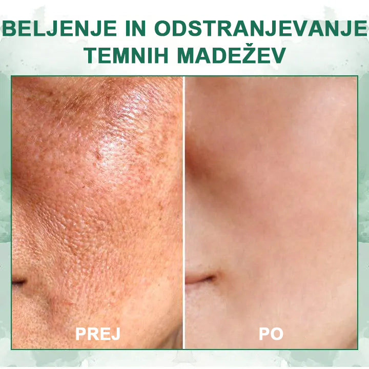 🌿Osvežite kožo v samo treh dneh💝𝙁𝙪𝙗𝙨𝙩𝙖™ pomlajevalni in učvrstitveni serum🔥