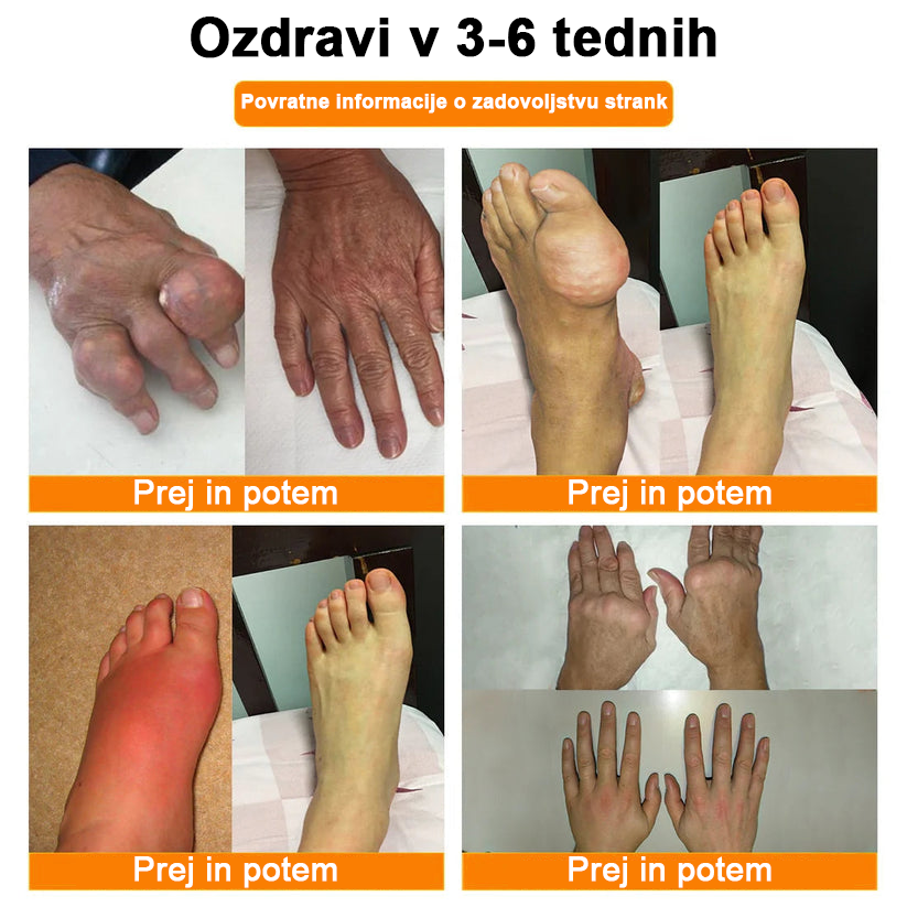 ✅Offizieller Shop: Ourlyard™ Magnezijevo olje & čebelji strup sprej za zdravljenje sklepov
