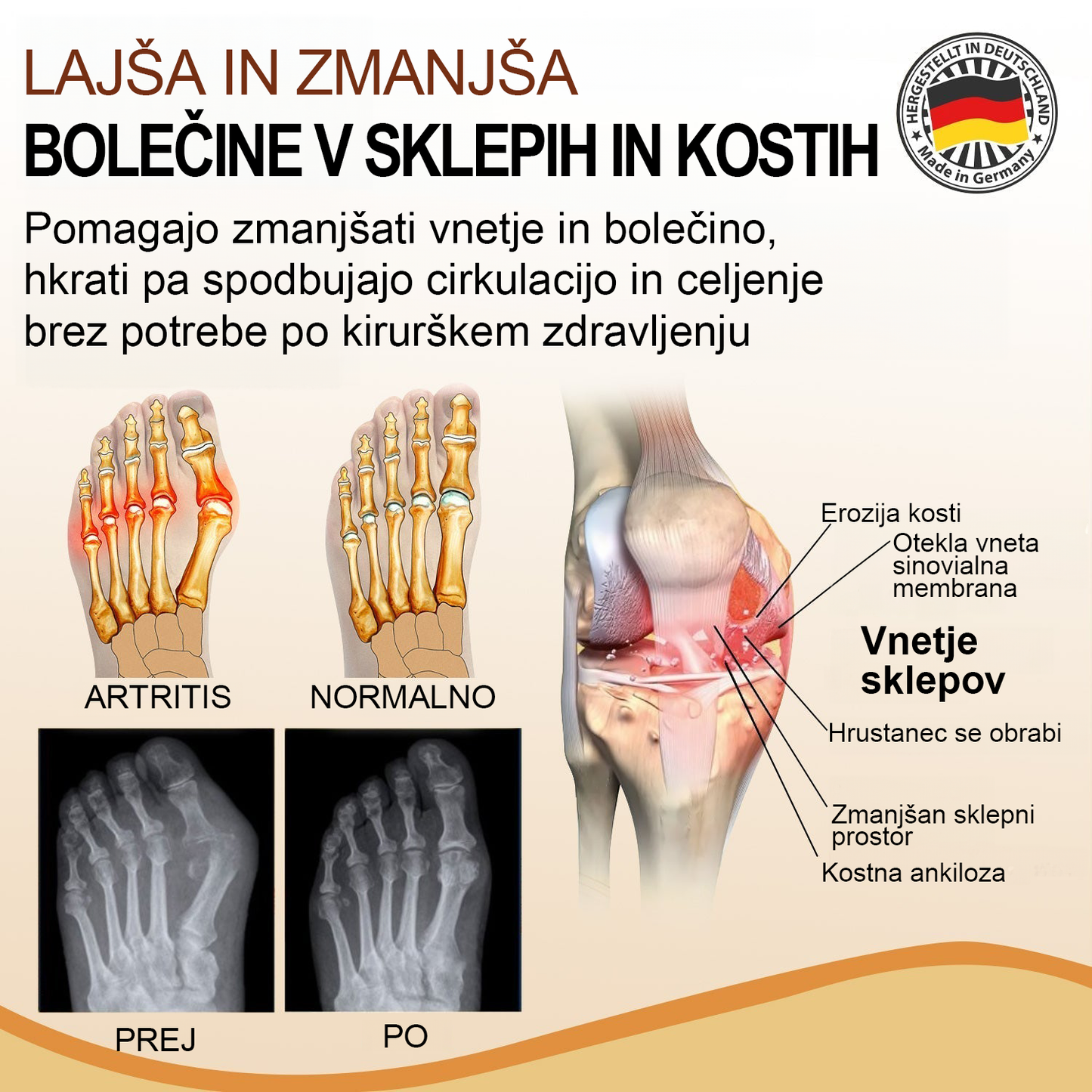🌿TODAHOF™ Sprej za sklepe s čebeljim strupom💎Primeren za vse starosti🔥 Časovno omejen 75% popust