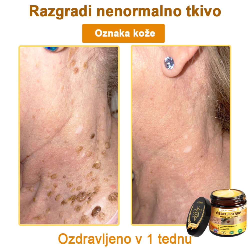 ZADNJA PRILOŽNOST! Zgrabi to srečno najdbo s 70 % Popustom! 🔥180-DNEVNO GARANCIJA VRAČILA DENARJA!
