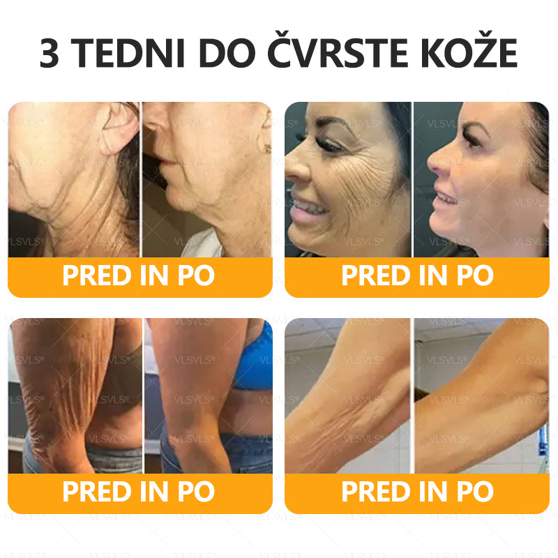 ✨ VLSVLS® krema za obnovo kože s čebeljim strupom 🔥 ZADNJI DAN 80% CENEJE