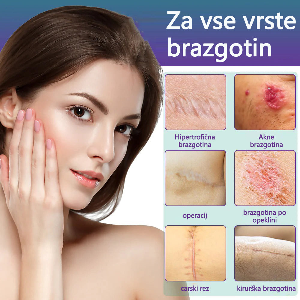🏷️ Uradna Trgovina: flysmus® ReGen Mikronadlaste Ploščice z Nano-Hialuronsko Kislino (Nano-Heal) 💝 Zdravljenje novih in starih brazgotin, zmanjševanje kirurških brazgotin, strij, keloidov, aken, opeklin, bradavic, dermatomov in krčnih žil