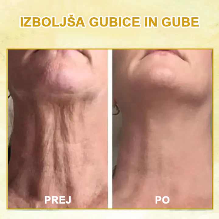 🌿𝐅𝐮𝐛𝐬𝐭𝐚® pomlajevalno olje za učvrstitev kože🩵 Zadnji dan popusta: 75 % CENEJE💧
