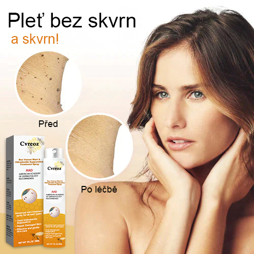 🐝🐝Cvreoz™ sprej za odstranjevanje bradavic in znamenj 🐝🐝🐝 (🔥Poslednja promocija 80% popust)