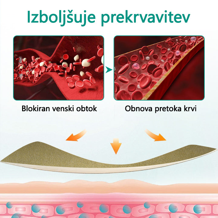 Timilk® LegRenew obliž za krčne žile izboljša zdravje ven in odpravi krčne žile – brez operacije