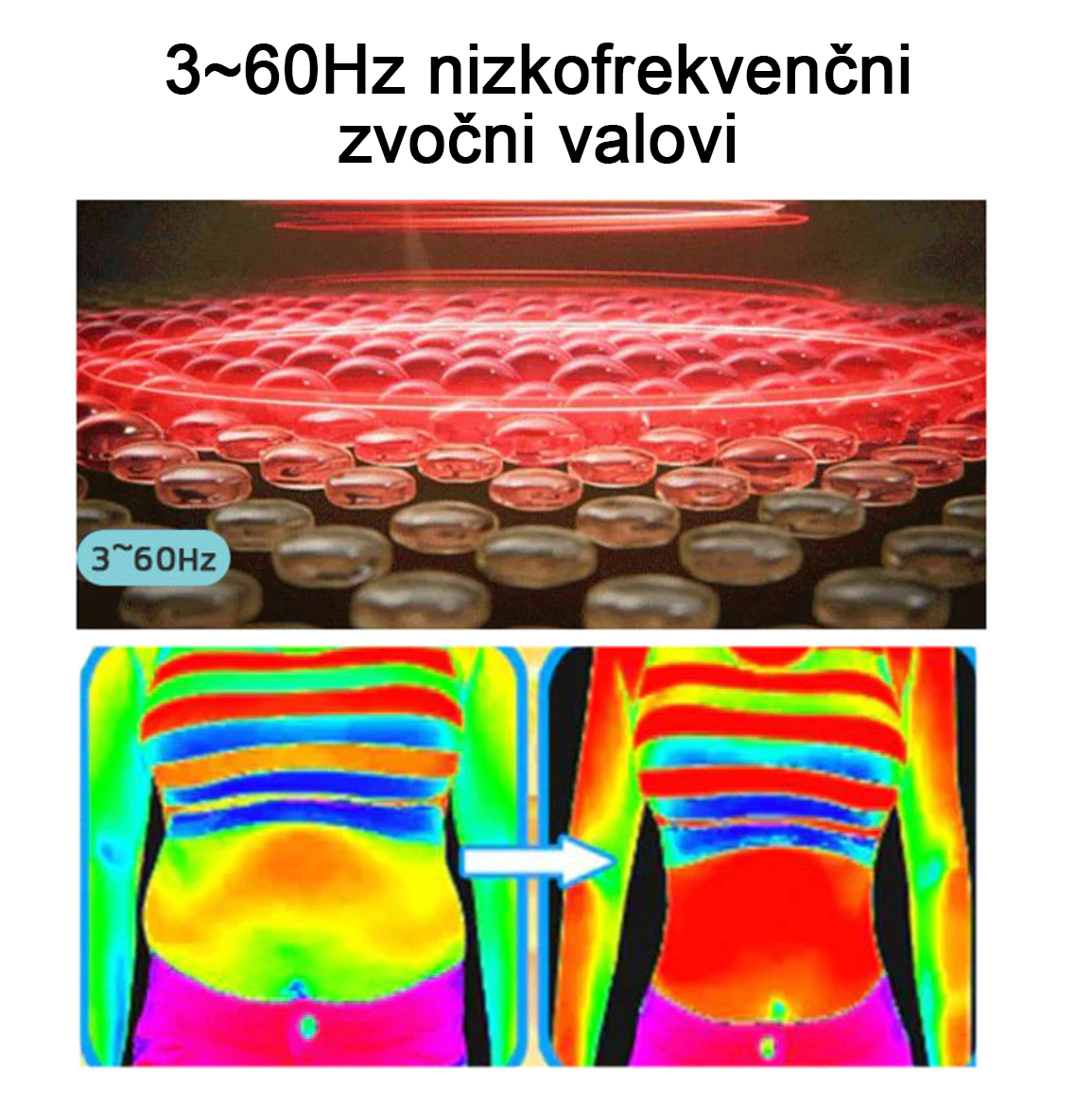👨⚕️𝙂𝙁𝙊𝙐𝙆™Ultrazvočna zapestnica za odstranjevanje maščob in razstrupljanje (🔥 ZADNJI DAN 70% CENEJE)