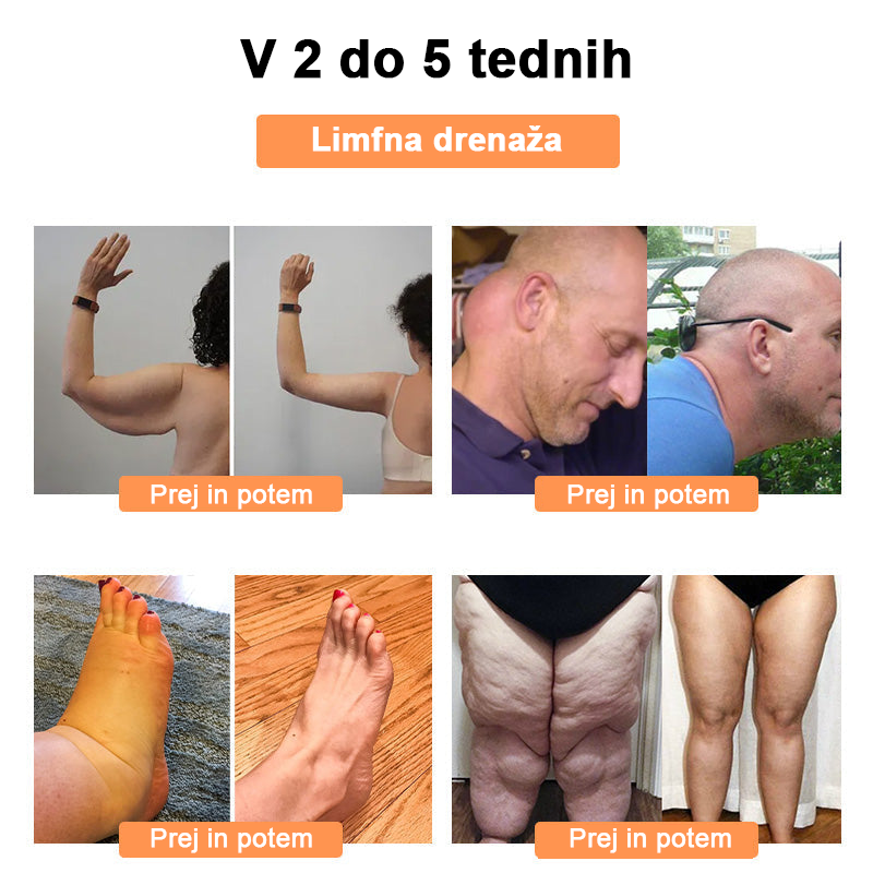 🍀🎈𝐅𝐑𝐎𝐏𝐔𝐍™ Čebelji strup Limfna drenaža obliž za hujšanje (Za vse limfatične težave in debelost)