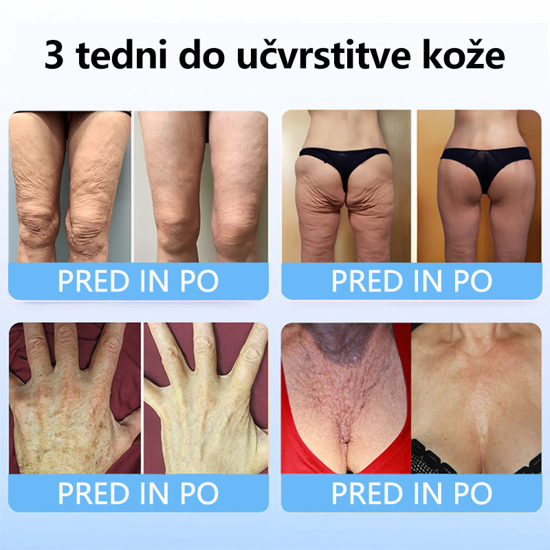 TLOPA™ Kolagenski Peptidi FIRMING SERUM PALČEK