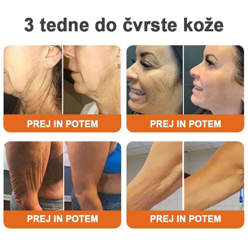 ✨Flysmus™ Botox Čebelji Strup Firming Stick🔥ZADNJI DAN 70 % CENEJE