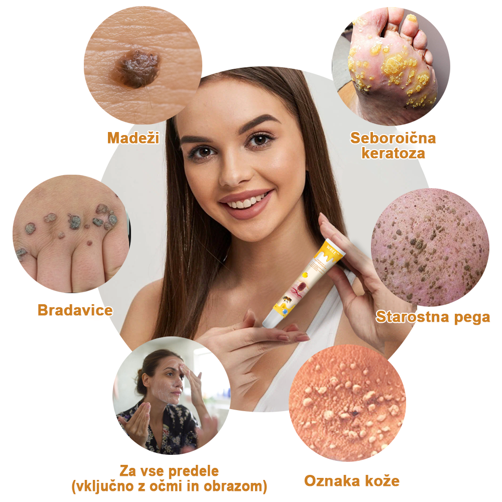 🌺𝙒𝙍𝙀𝙀™ Krema za odstranjevanje bradavic in oznak s čebeljim strupom (👨⚕Primerna za vse tipe kože)🐝(🔥Promocija zadnji dan 70% popust)